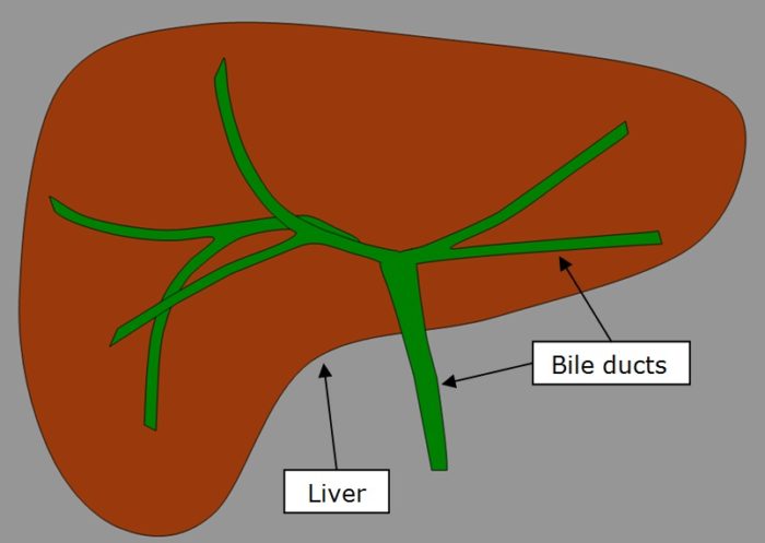 Biliary Drainage - InsideRadiology